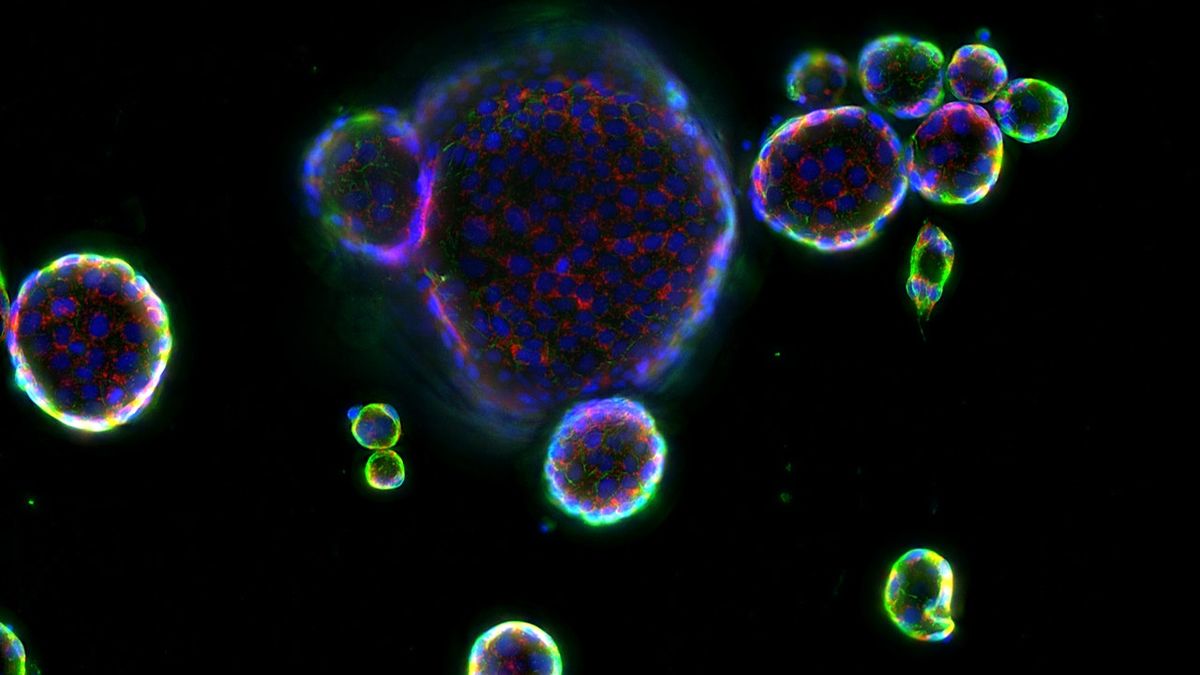 RNAscope\u2122: Advancing Beyond Single-Cell Multi-Omic Strategies.