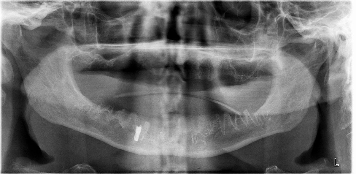 Variants of Normal Anatomy that May Simulate Disease