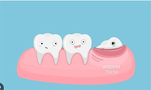 Wisdom Teeth Management: A Comprehensive Guide for Dental Hygienist