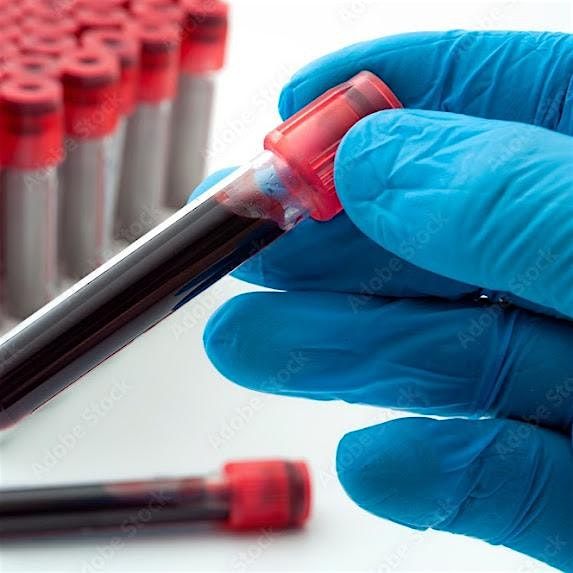 Become a Certified Phlebotomy Technician in Just 6 Weeks! Hands-On Training