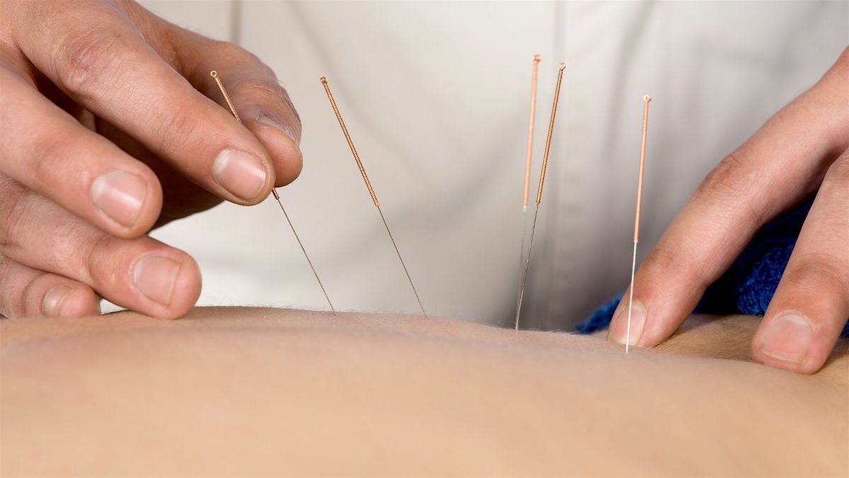 Acupuncture Foundation Course (5-days)