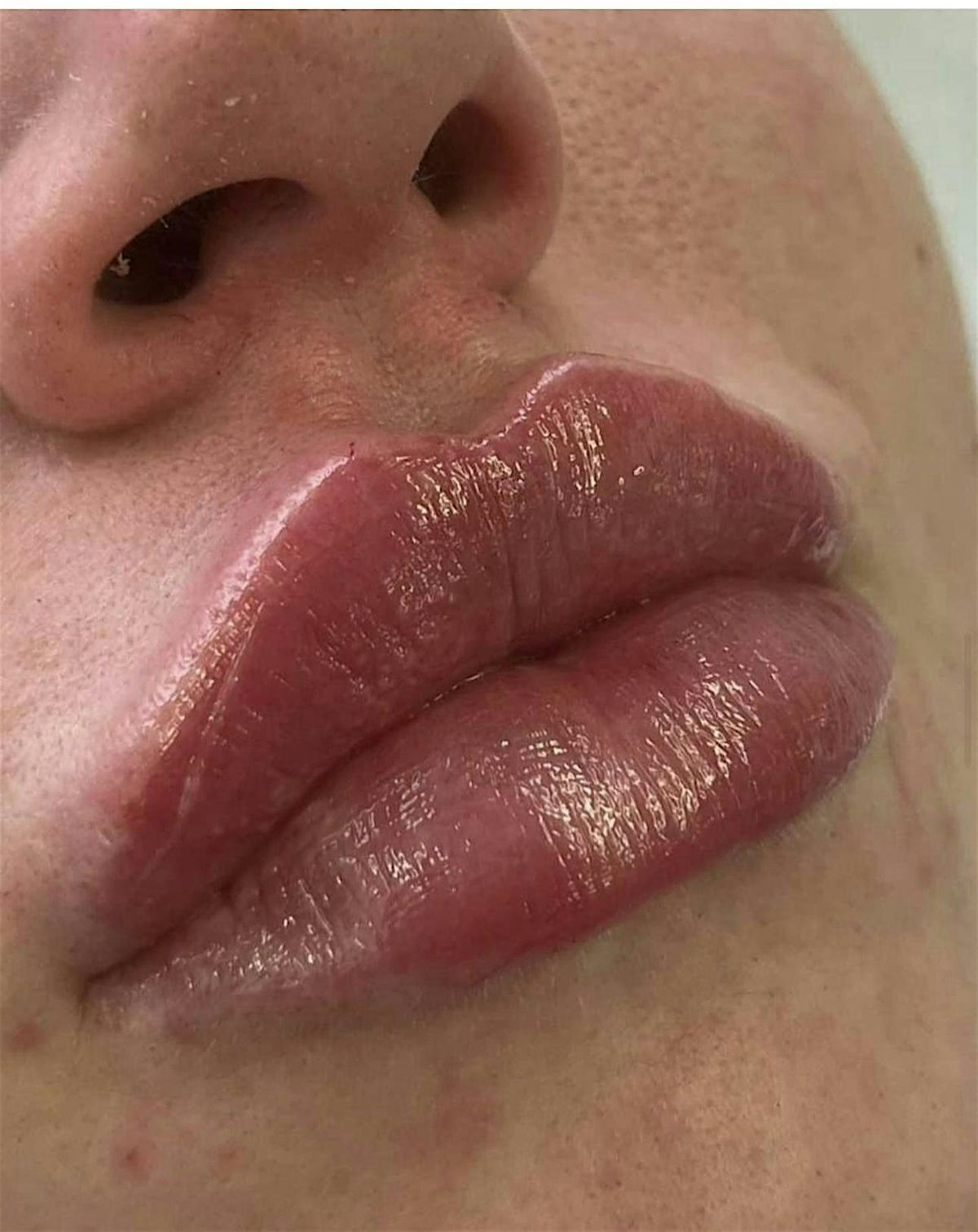 Lip filler & Permanent Makeup Training