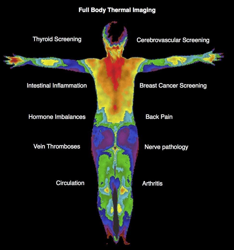 Thermography 