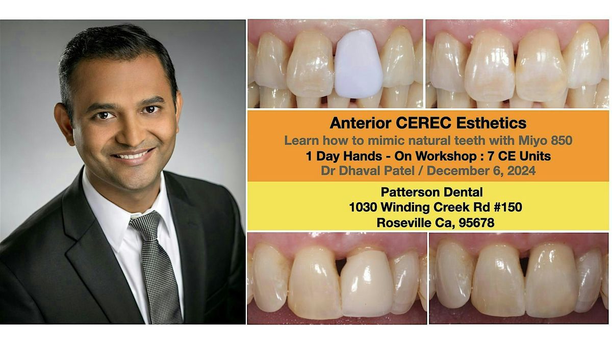 Anterior CEREC Esthetics