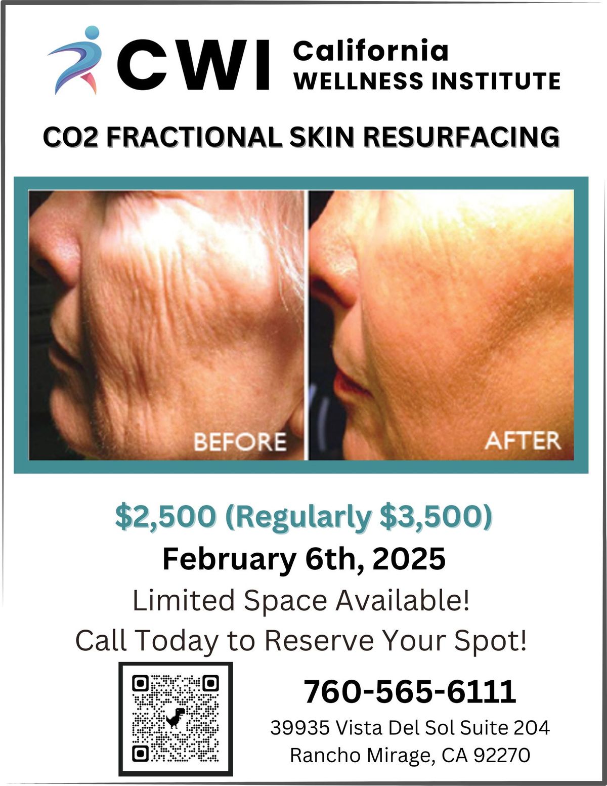 CO2 Fractional Skin Resurfacing