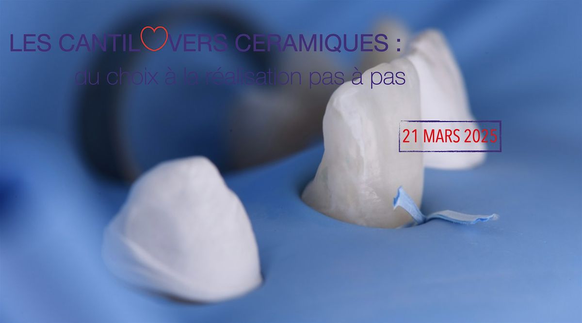 LES CANTILOVERS CERAMIQUES :\u2028 du choix \u00e0 la r\u00e9alisation pas \u00e0 pas