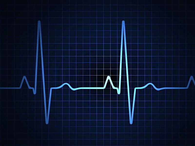 12 (15) Lead ECG and STEMI Presented by Stryker