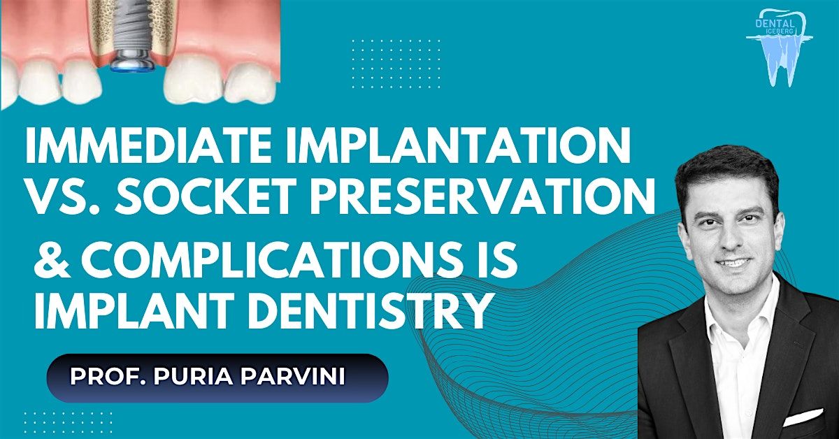 Immediate Implant Placement vs. Ridge Preservation Course