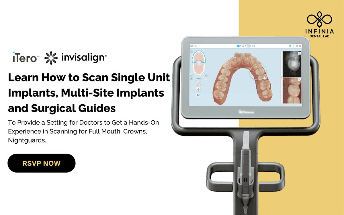 Itero Part 2: Learn How to Scan Single Unit Implants, Multi-Site Implants and Surgical Guides