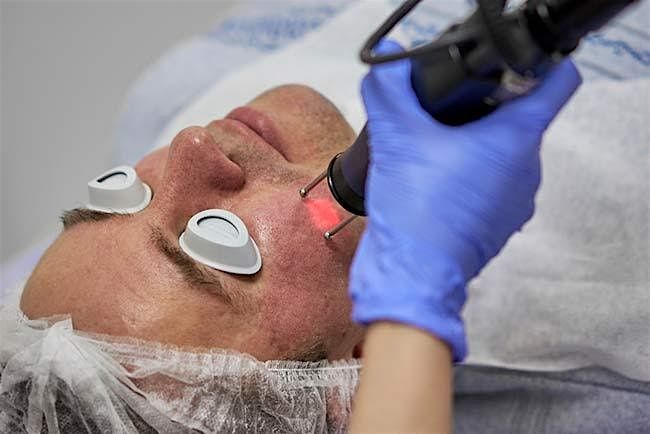 Cosmetic Laser Courses and Certification - Anaheim, CA