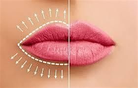 Lip fillers and permanent makeup training