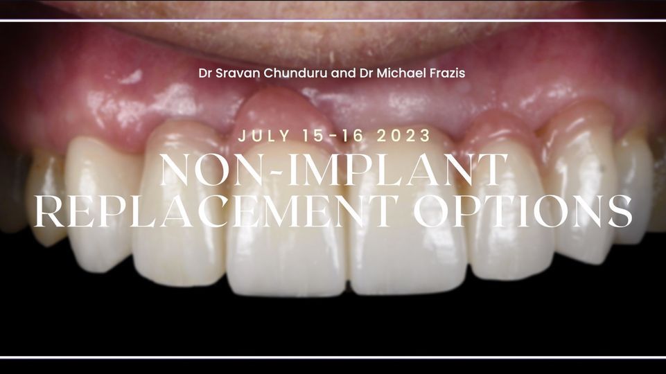 Non-Implant replacement options for single missing teeth 2023