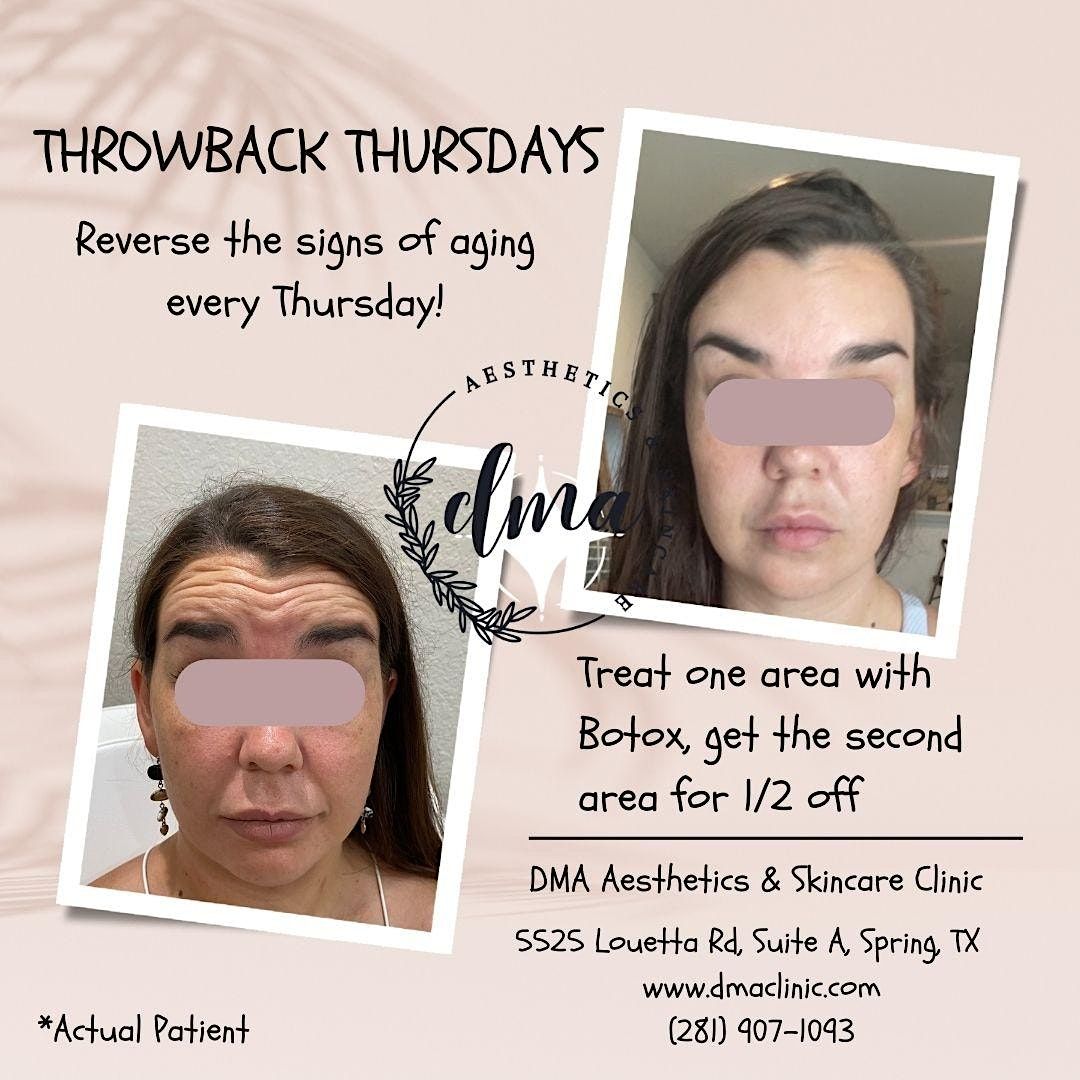 Throwback Thursdays - Reverse The Signs Of Aging With Botox, DMA ...