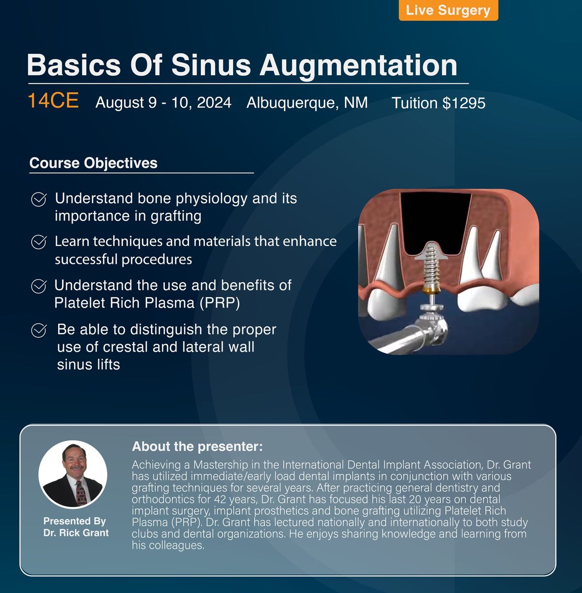 Basics Of Sinus Augmentation