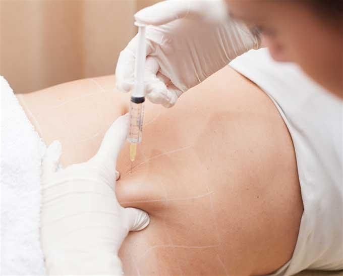 Mesotherapy Training - Nashville, TN