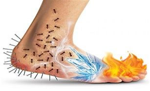 Peripheral Neuropathy - Natural, Efffective Solutions