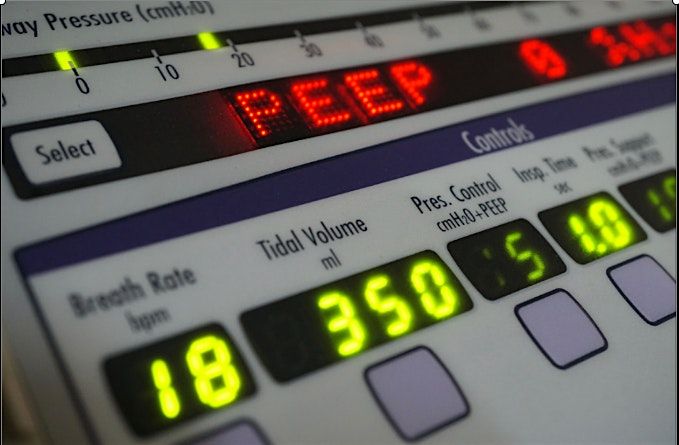 ADVANCEMENTS AND INSIGHTS IN MECHANICAL VENTILATION IN THE ICU PART 1