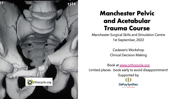 Manchester Pelvic and Acetabular Trauma Course