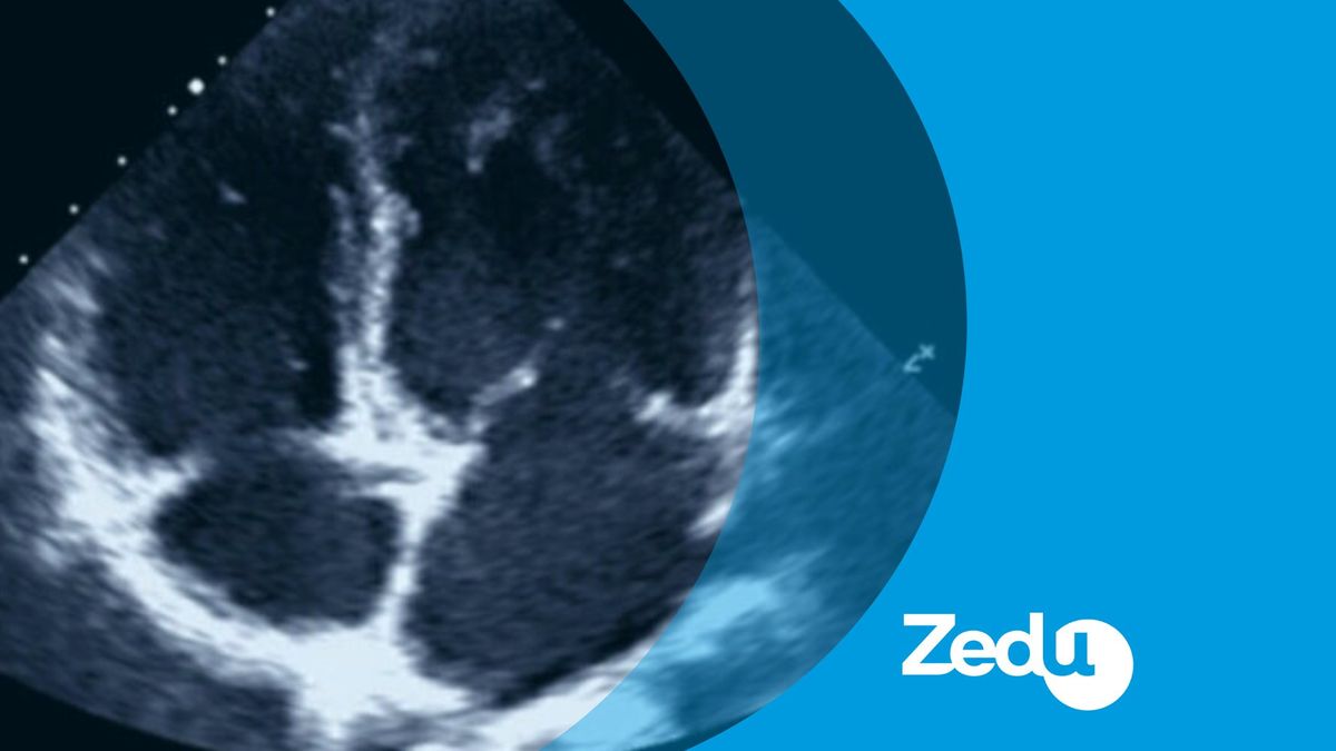 Zedu Focused Cardiac Ultrasound