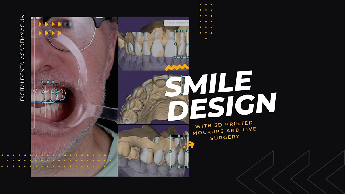 Guided Smile Concept: Minimally Invasive DIGITAL Same Day Smile Design