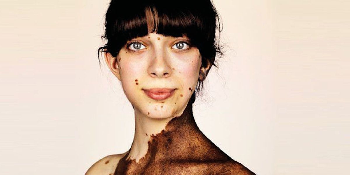 3rd Crick Rare Diseases Conference