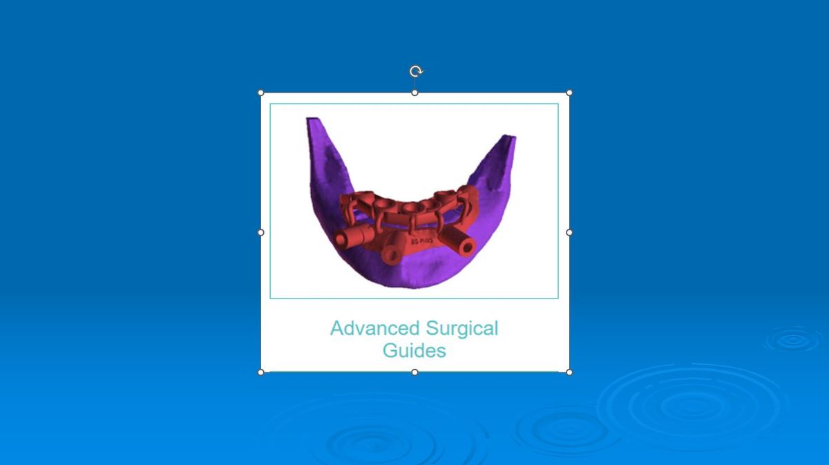 Advanced Surgical Guides