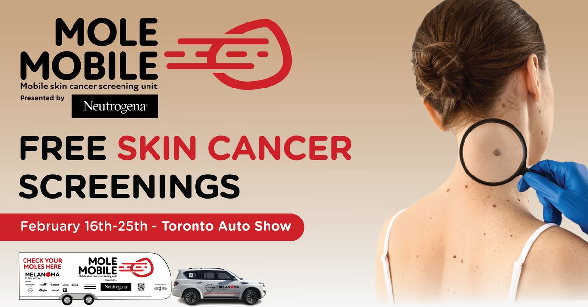 Free Skin Cancer Screenings at the Toronto Auto Show, Metro Toronto ...