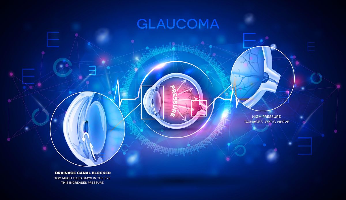 Cataract and Glaucoma Symptoms and Treatments