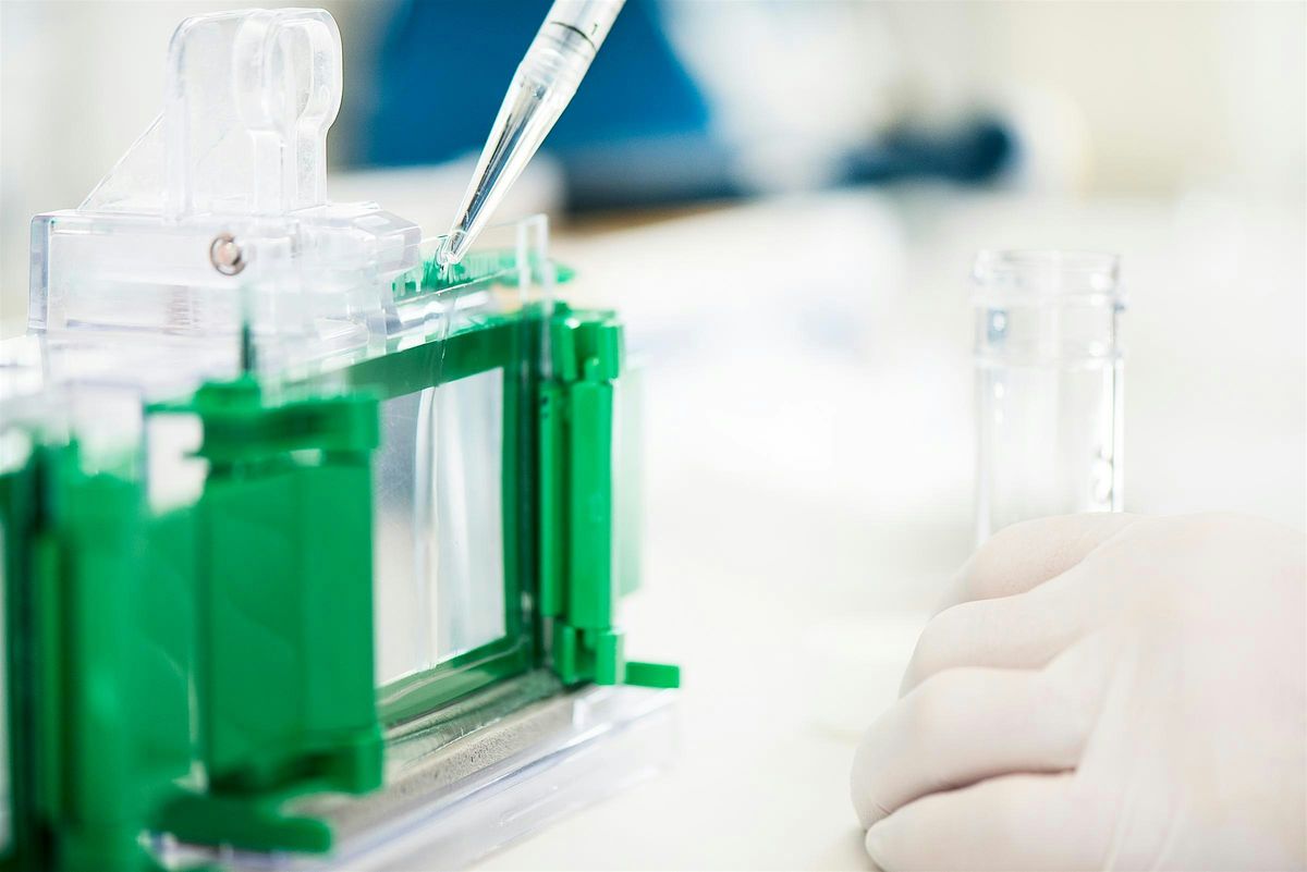 Immunoprecipitation and Western Blot Workshop