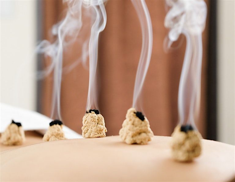 Integrating Moxibustion For Health In The Childbearing Years