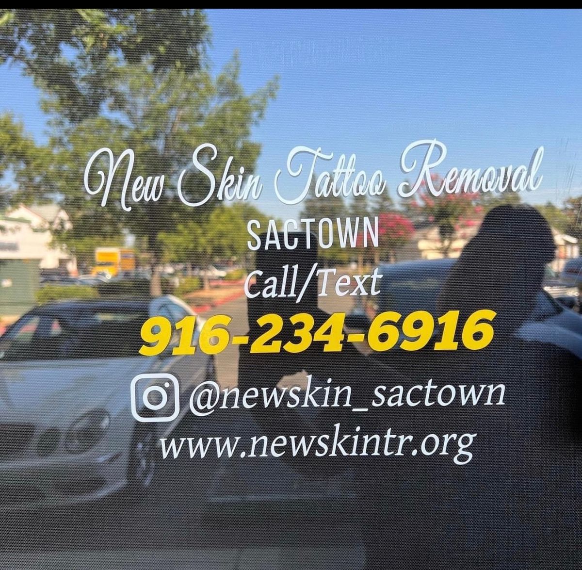New Skin Tattoo Removal SacTown