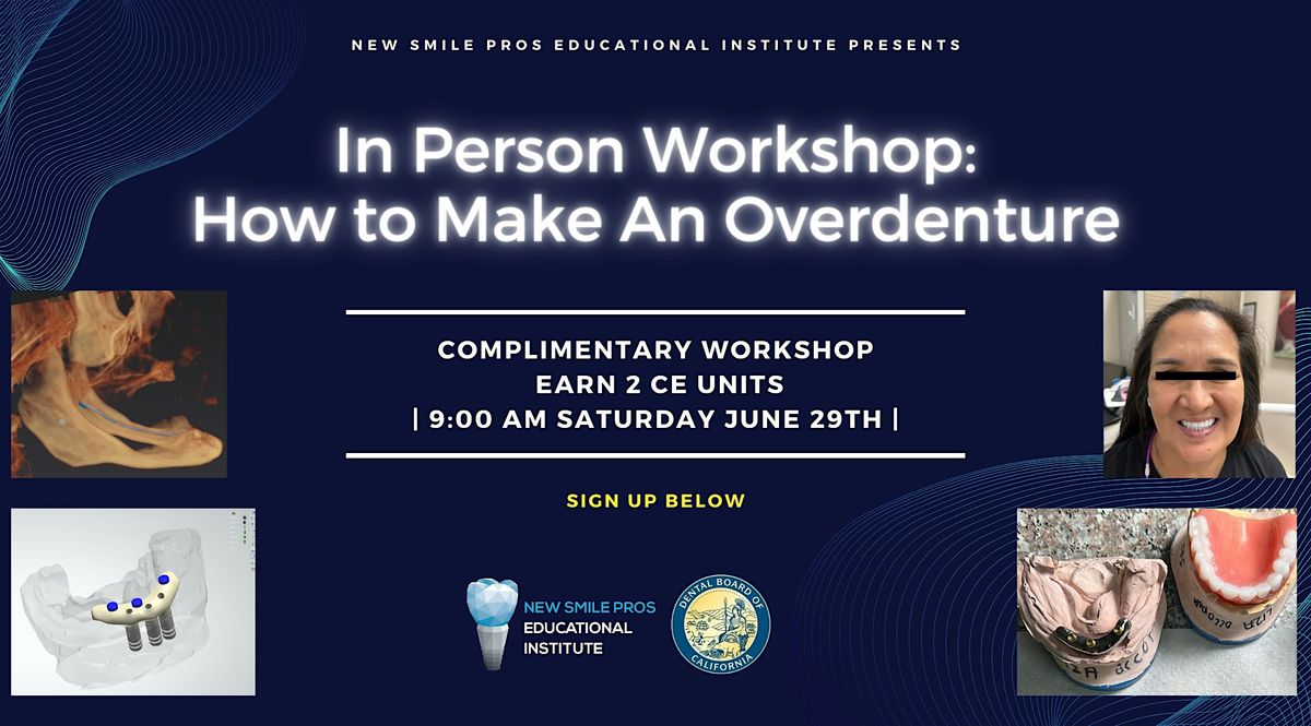 Workshop: How to Make An Overdenture