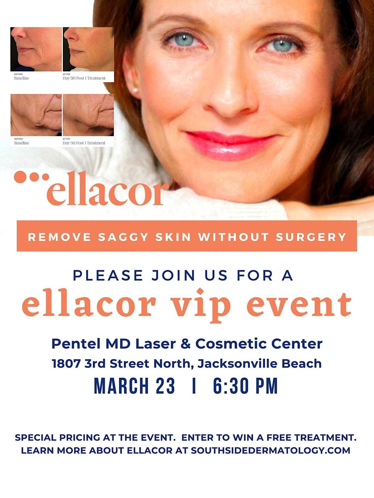Ellacor VIP event! The new nonsurgical alternative to a facelift