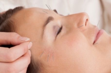 AcuRestore\u2026a restorative acupuncture and sound meditation workshop