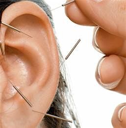 Auricular Acupuncture - 1 day course