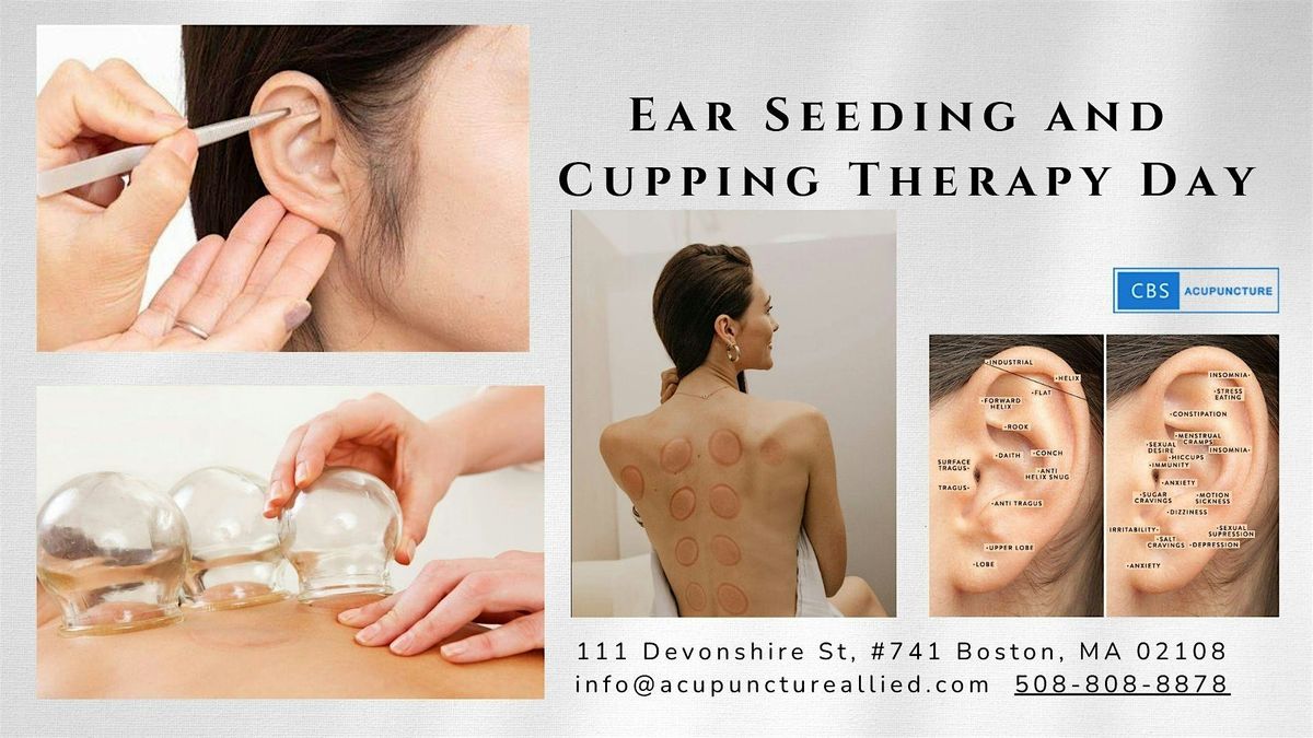 Ear Seeding and Cupping Therapy Day!