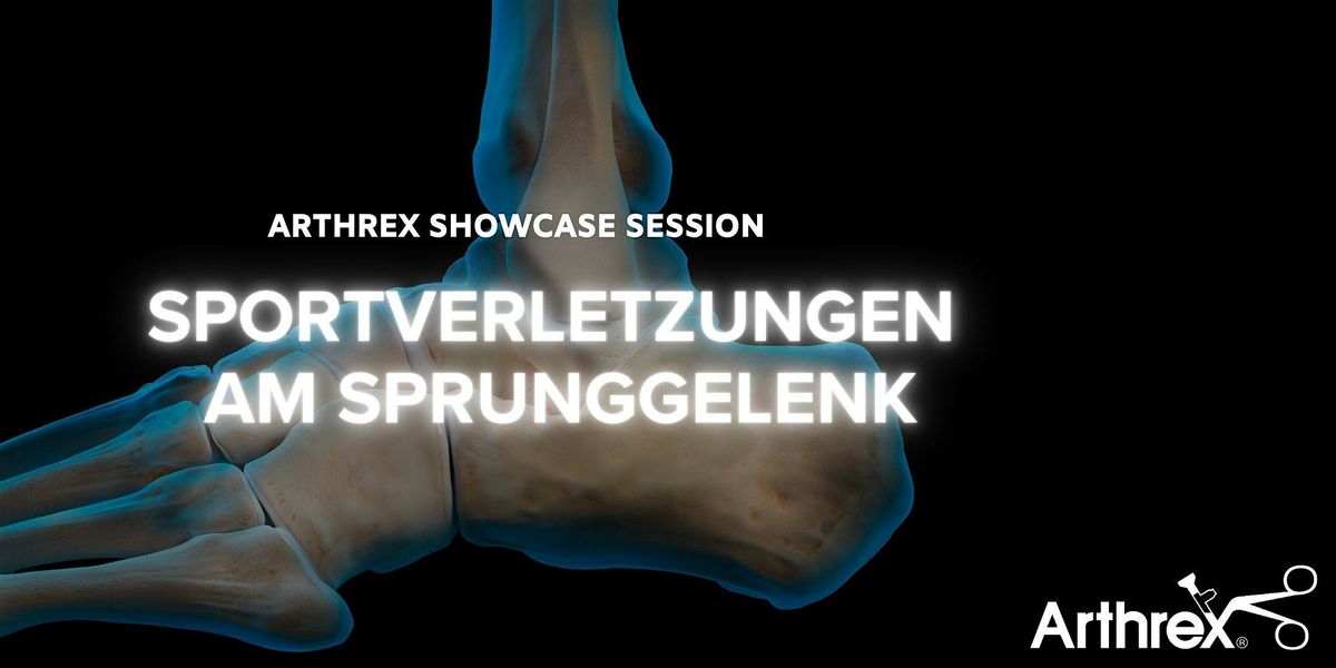 Arthrex ShowCase Session \u2013 Sportverletzungen am Sprunggelenk