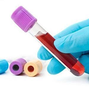 Phlebotomy (Venepuncture) Training - In Person - NEWCASTLE