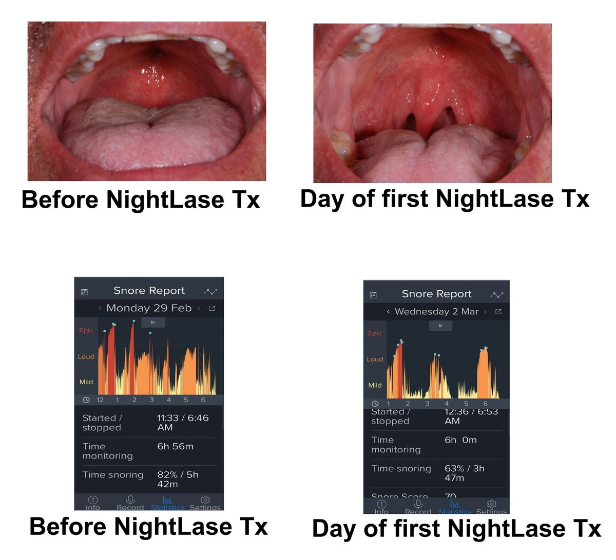 Soft & Hard Tissue Dental Lasers with Aesthetic Capabilities; 8 CE Credits