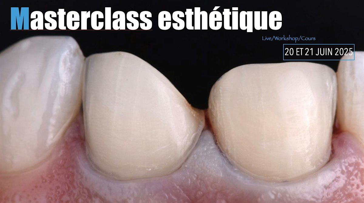 Masterclass esth\u00e9tique autour des facettes en c\u00e9ramiques