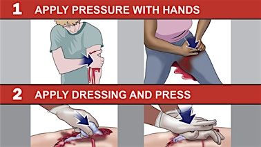 Stop the Bleed Course