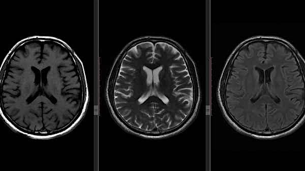 Differentials in Neuroradiology CPD Course for Radiologists in Training