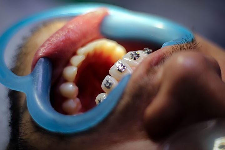 Level UP Orthodontics for the dental Hygienist and OHT Adelaide