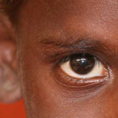 Indigenous Eye Health Unit