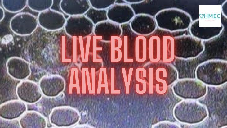 Live Blood Analysis with our Analyst\/ Nutrionist 