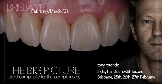direct composite for the complex case