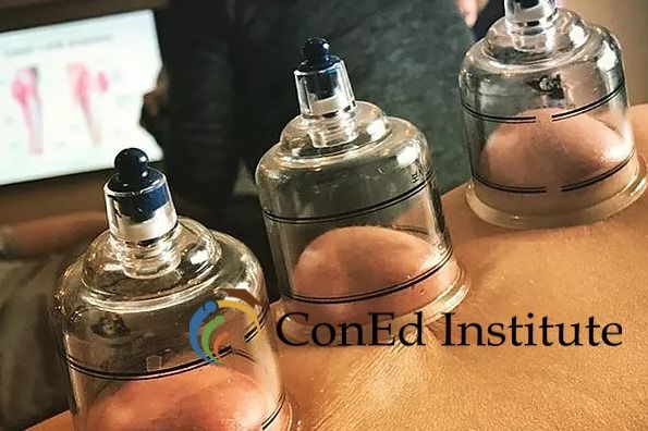 Advanced Treatment Perspectives: Cupping as a Soft Tissue Tool