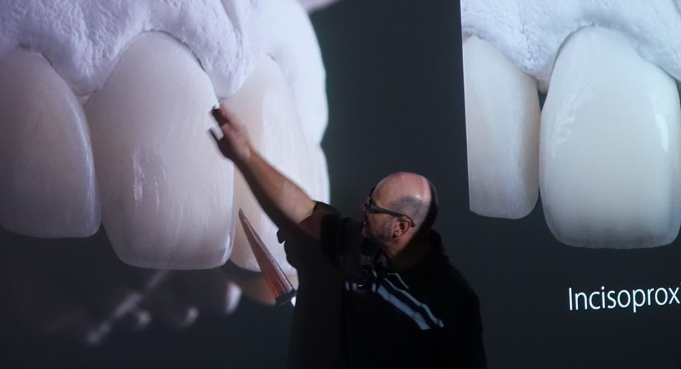 STATE OF THE ART in ANTERIOR VENEERING TECHNIQUES - Master Program with ...