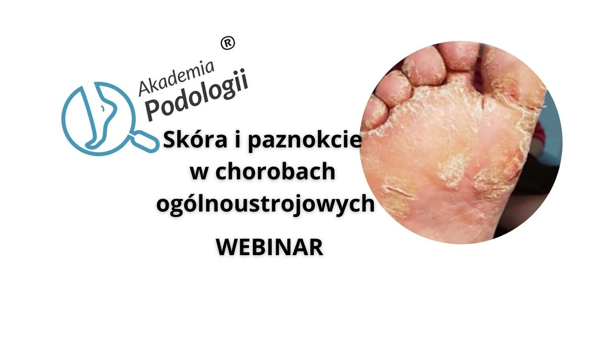 webinar :  Sk\u00f3ra i paznokcie w chorobach og\u00f3lnoustrojowych - spotkanie edukacyjne