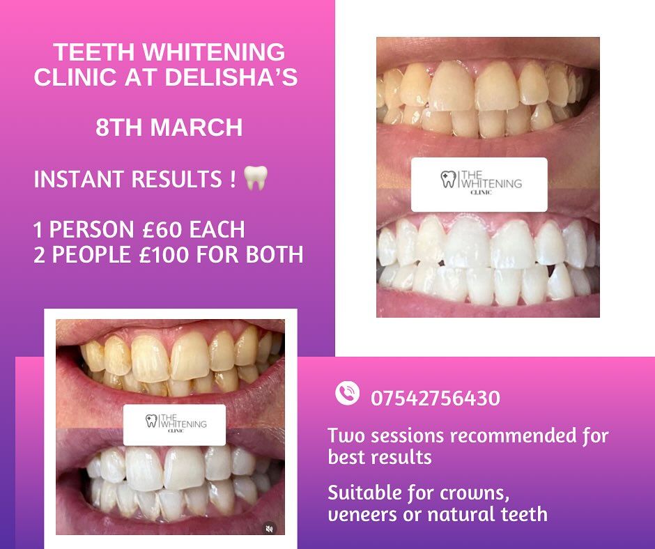 Teeth whitening 